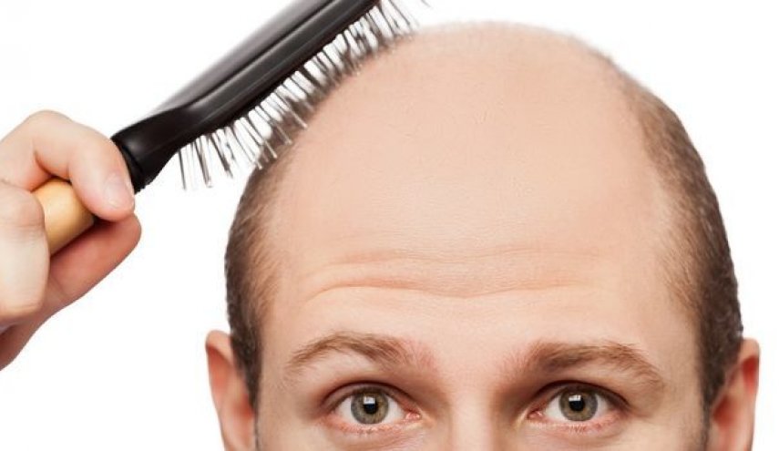 علاج عشبي شائع قد يوقف السبب الرئيسي للصلع الذكوري لتعزيز نمو الشعر الجديد
